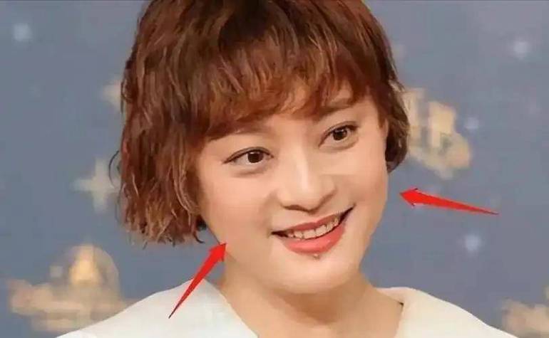 新门内部资料免费提供和孙俪唇下痣没了与孙俪嘴唇的痣