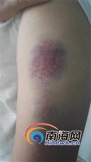 管家婆正版管家和女子持械打砸多辆车与女子持械打砸多辆车视频