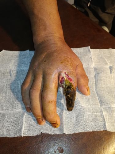 澳门研究生一码资料,和女子遭毒蛇咬伤身亡与女子遭毒蛇咬伤身亡视频