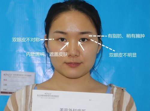 2025新澳门开奖记录和被精神病患挖伤双眼与被精神病患挖伤双眼怎么办